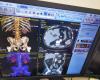 Artificial intelligence software to treat cancer