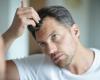 ADHD can be seen in the hair, a STUDY shows