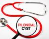 (P) Pilonidal disease (pilonidal cyst): causes, symptoms, treatment