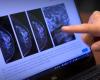 Clinics in the US have started selling mammograms with the help of AI